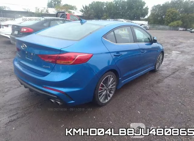 KMHD04LB8JU480865 фото 5