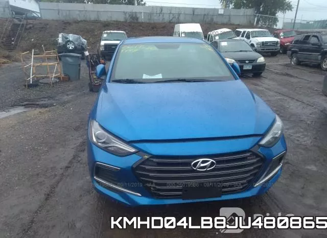 KMHD04LB8JU480865 фото 7
