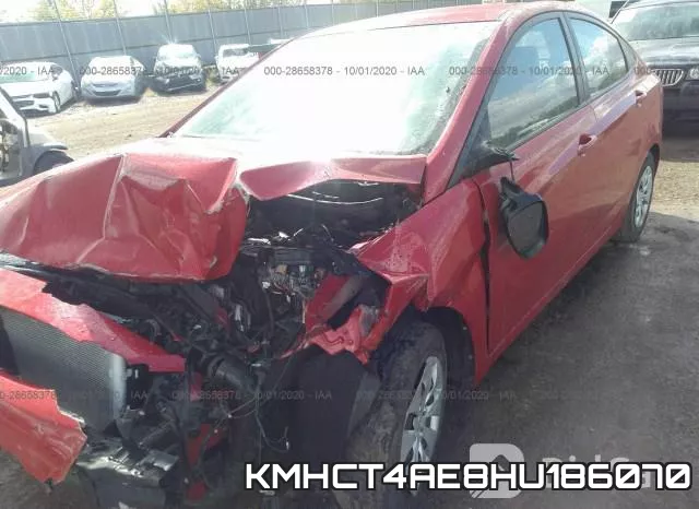 KMHCT4AE8HU186070 фото 7