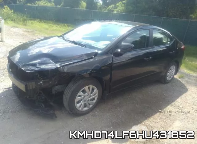 KMHD74LF6HU431852 фото 3