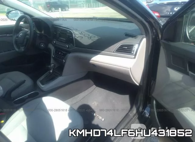 KMHD74LF6HU431852 фото 6