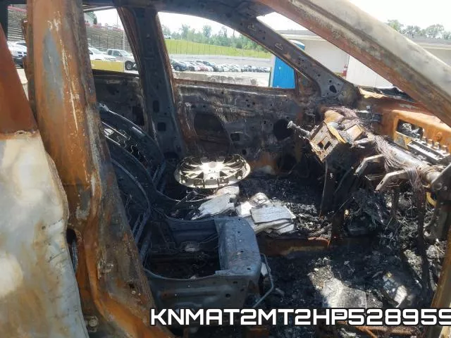 KNMAT2MT2HP528959 фото 6