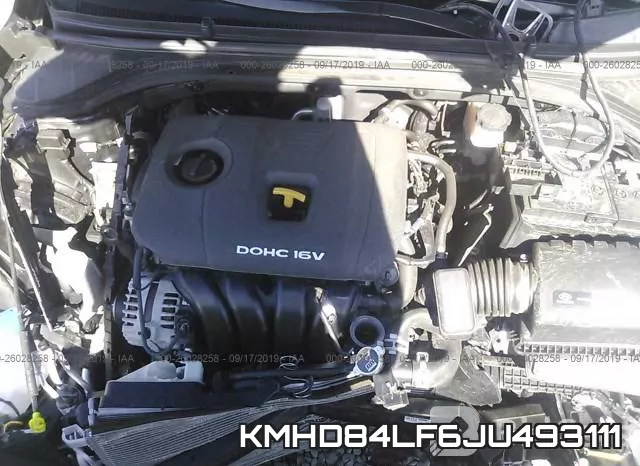 KMHD84LF6JU493111 фото 2