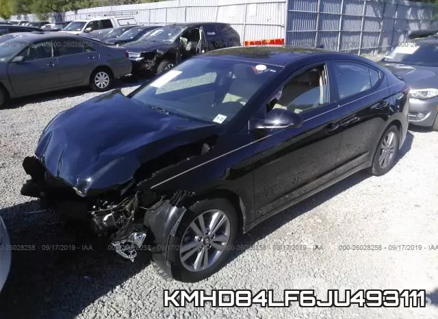 KMHD84LF6JU493111 фото 3
