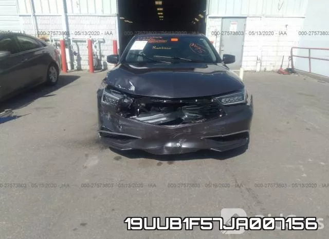 19UUB1F57JA007156 фото 7