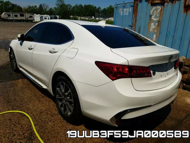 19UUB3F59JA000589 фото 4