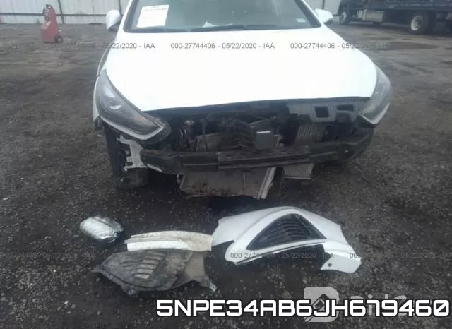 5NPE34AB6JH679460 фото 7