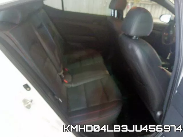 KMHD04LB3JU456974 фото 7