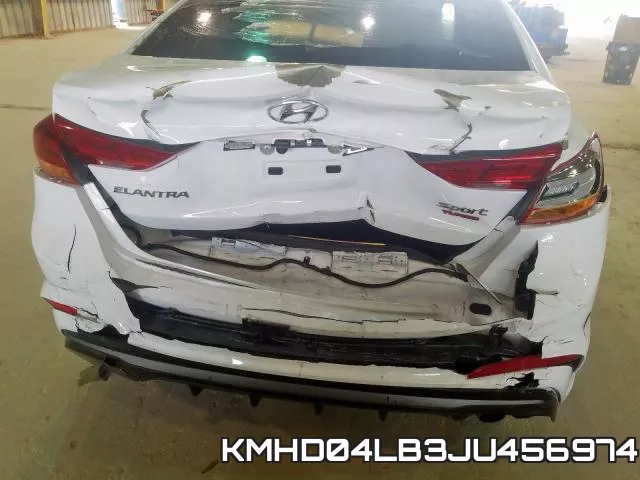 KMHD04LB3JU456974 фото 10