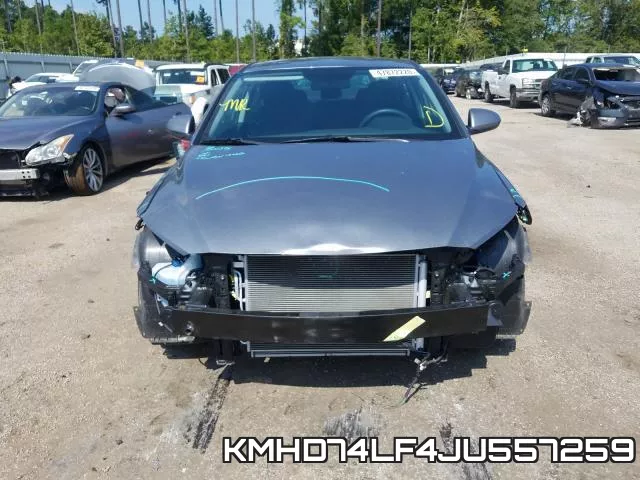 KMHD74LF4JU557259 фото 10