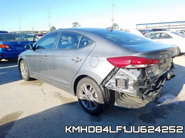KMHD84LF1JU624252 фото 3