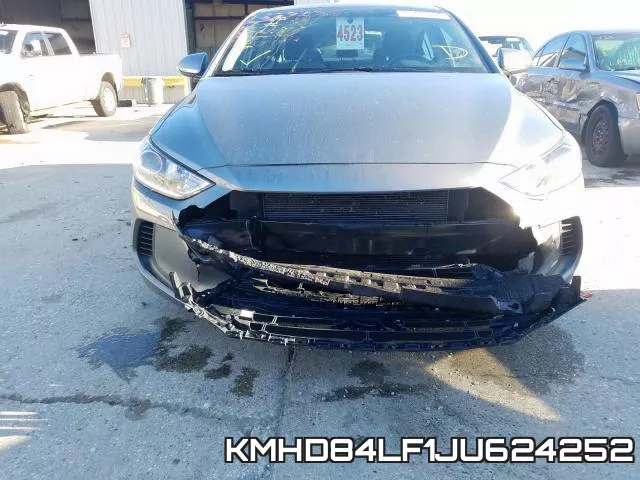 KMHD84LF1JU624252 фото 9