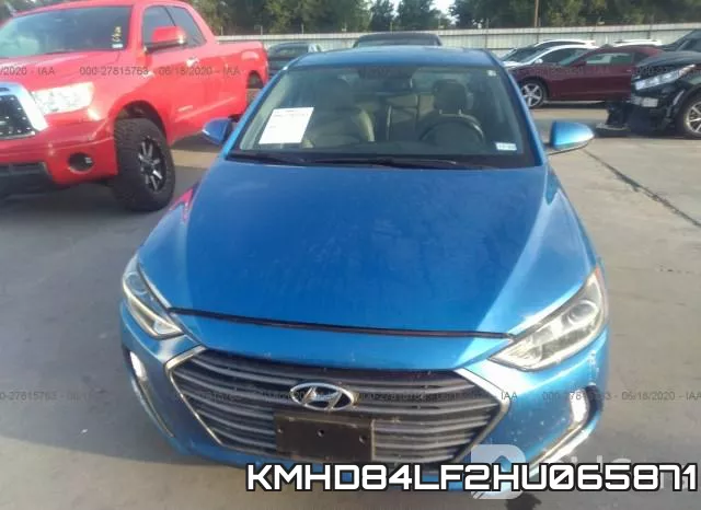 KMHD84LF2HU065871 фото 7