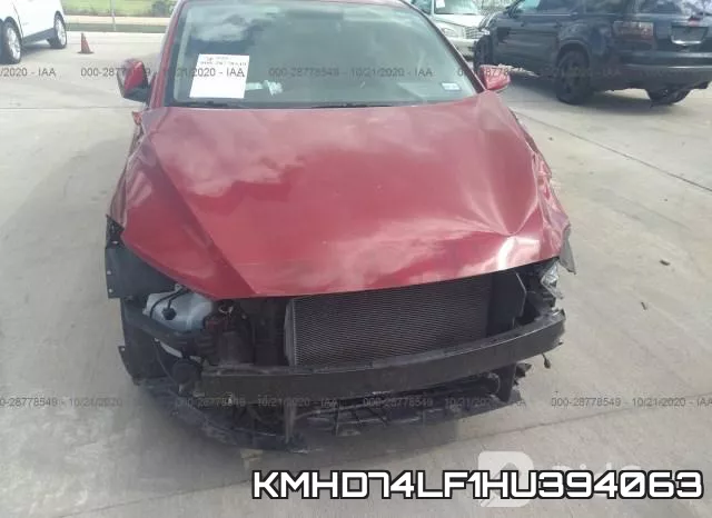 KMHD74LF1HU394063 фото 7