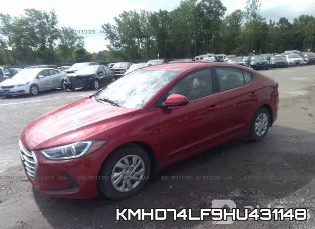 KMHD74LF9HU431148 фото 3