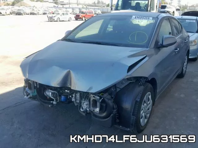 KMHD74LF6JU631569 фото 3
