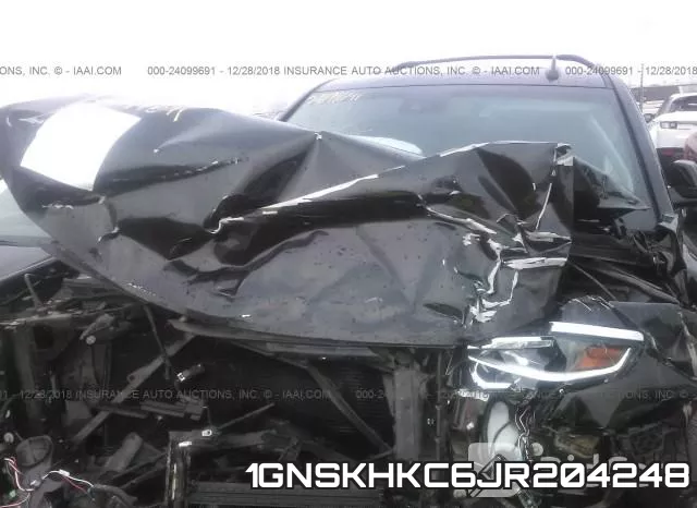 1GNSKHKC6JR204248 фото 2