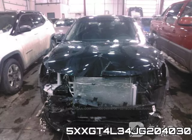5XXGT4L34JG204030 фото 7