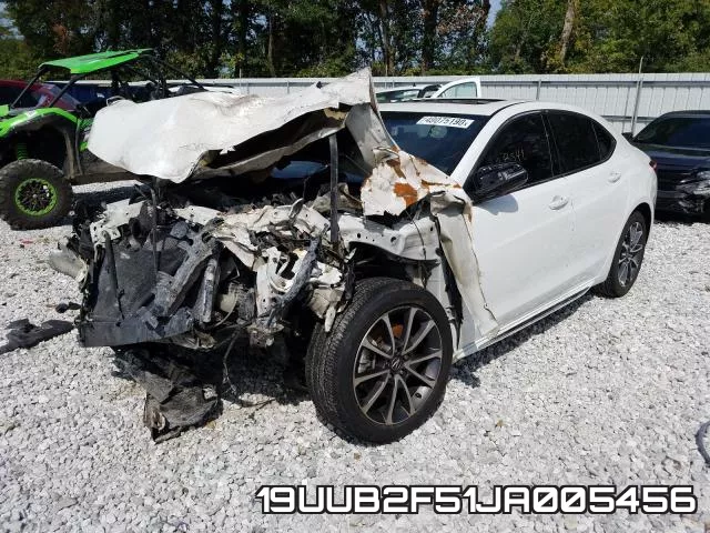 19UUB2F51JA005456 фото 3