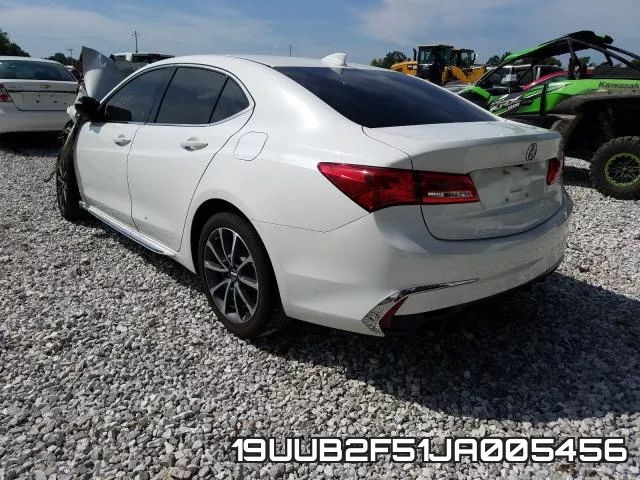 19UUB2F51JA005456 фото 4