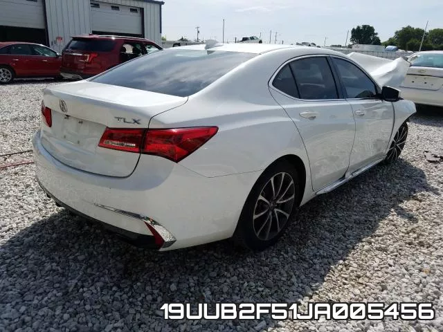19UUB2F51JA005456 фото 5