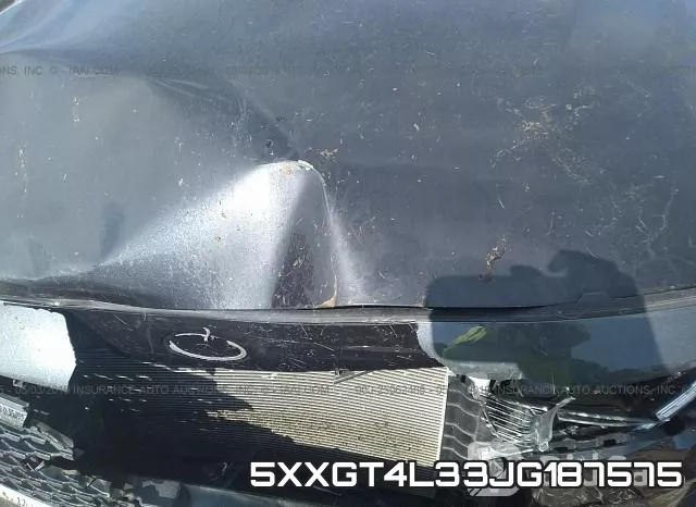 5XXGT4L33JG187575 фото 2
