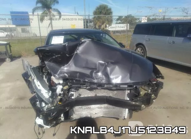 KNALB4J17J5123849 фото 7