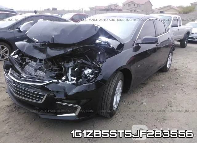 1G1ZB5ST5JF283556 фото 3
