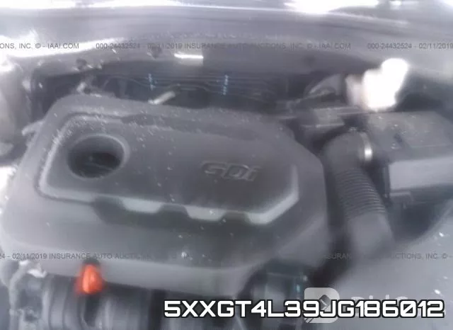 5XXGT4L39JG186012 фото 2