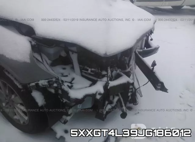 5XXGT4L39JG186012 фото 7